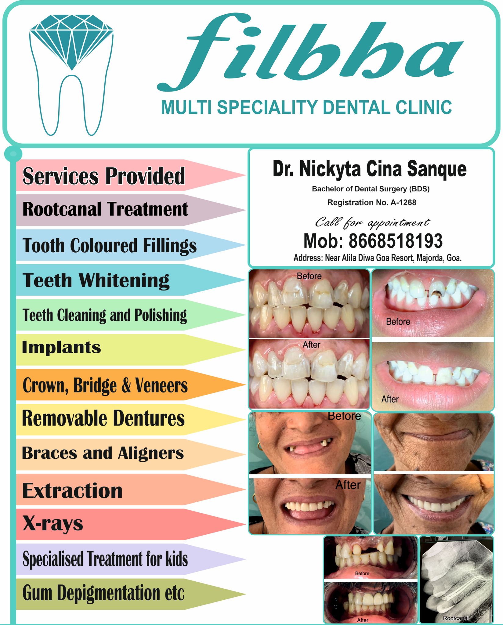 http://10%%20Discount%20at%20Filbha%20Multi%20speciality%20Dental%20Clinic%20in%20Goa